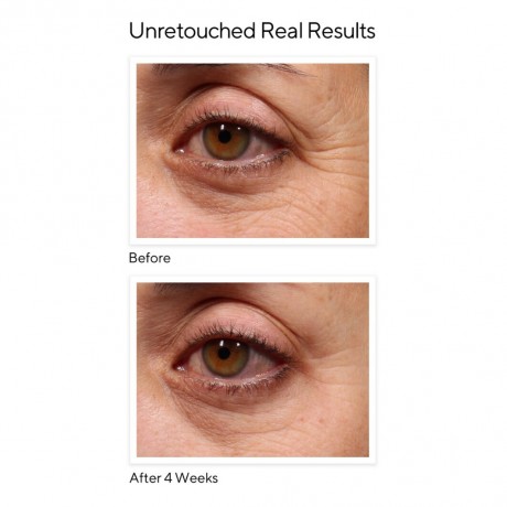 MURAD Retinol Youth Renewal Eye Serum Обновляющая сыворотка для кожи вокруг глаз с ретинолом