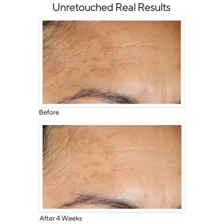 MURAD Vita-C Brightening Serum Осветляющая сыворотка Vita-C