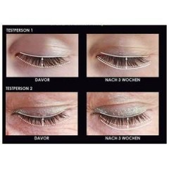 Chiara Ambra Lash Serum Сыворотка для ресниц
